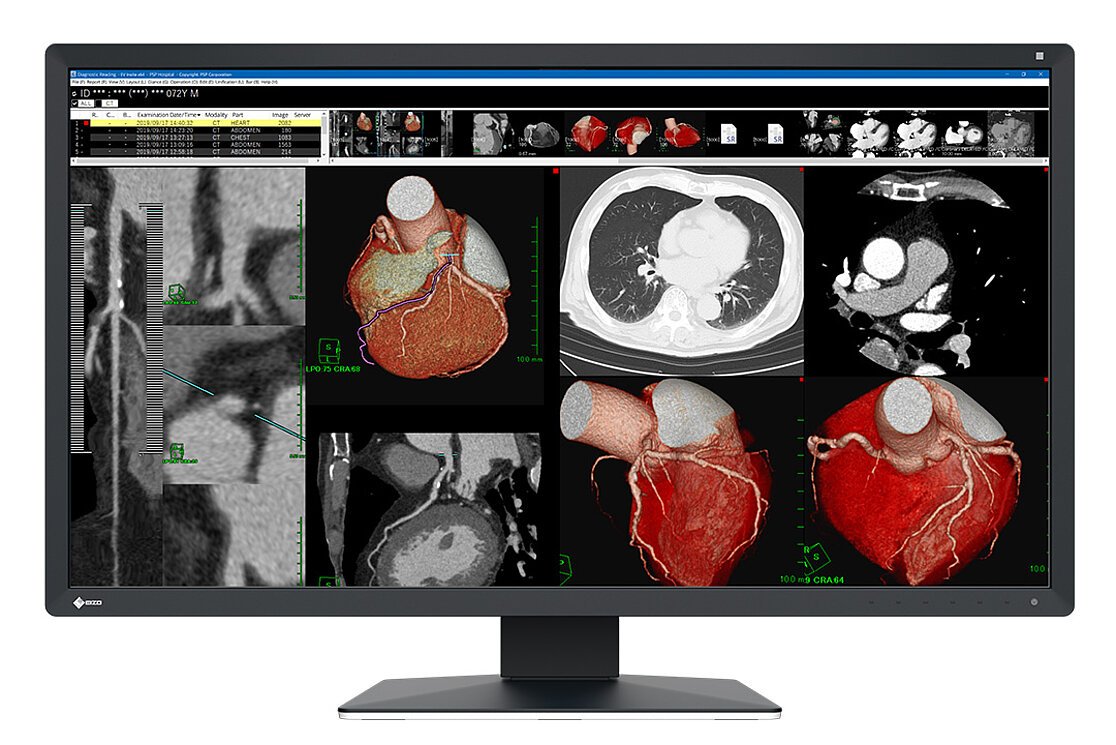 EIZO RadiForce MX317W computer monitor 77.5 cm (30.5") 4096 x 2160 pixels 4K DCI LCD Black MX317W-BK