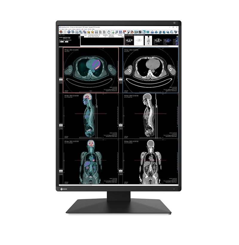 EIZO RadiForce RX370 computer monitor 54.1 cm (21.3") 1536 x 2048 pixels LCD Black RX370-BK