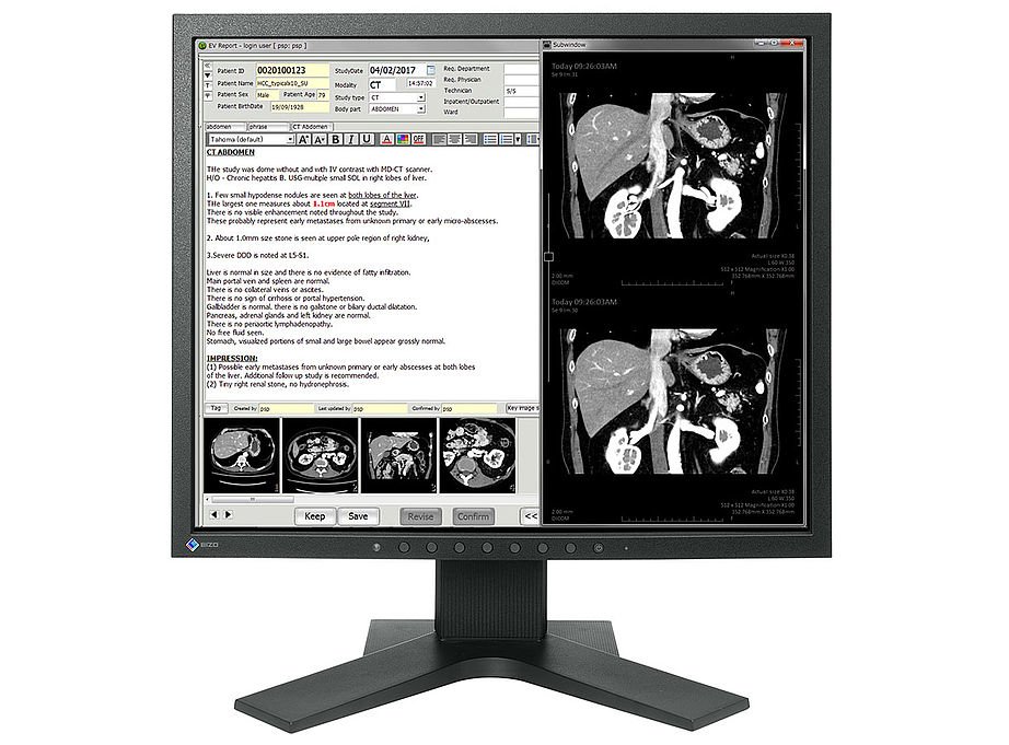 EIZO RadiForce MX194 computer monitor 48.3 cm (19") 1280 x 1024 pixels LCD Black MX194-BK